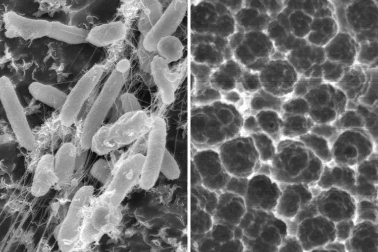 Imagem microscópica da bactéria PETase.